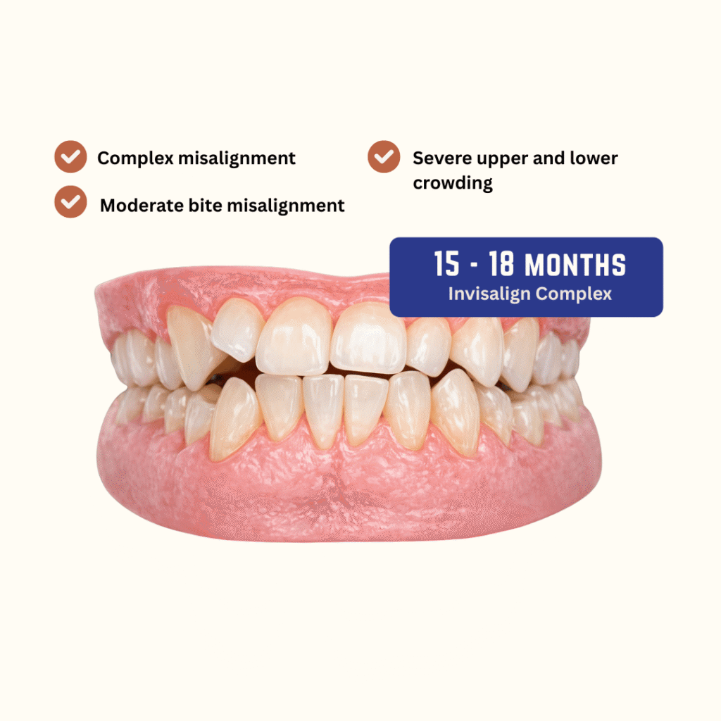 Invisalign Complex - kohe™ Dental