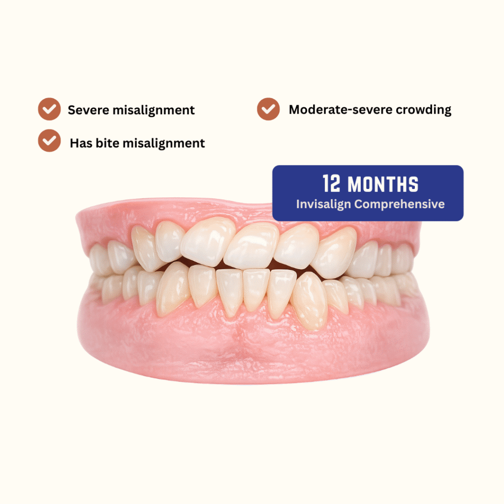Invisalign Comprehensive - kohe™ Dental